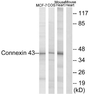 Western blot analysis of lysates from MCF-7/COS7/Mouse Heart using Anti-Connexin 43 Antibody The right hand lane represents a negative control, where the antibody is blocked by the immunising peptide