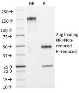 Anti-HSP27 antibody