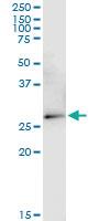 Anti-VDAC2 Mouse Monoclonal Antibody [clone: 3D2]