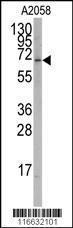 Anti-ROR alpha Rabbit Polyclonal Antibody (Biotin)