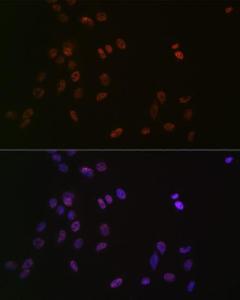 Immunofluorescence analysis of C6 cells using Anti-ASH2L Antibody [ARC0326] (A305306) at a dilution of 1:100 (40x lens). DAPI was used to stain the cell nuclei (blue).