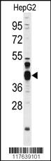 Anti-FEN1 Rabbit Polyclonal Antibody