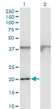 Anti-FTL Mouse Monoclonal Antibody [clone: 1C14]