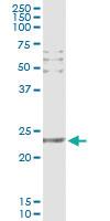 Anti-CD69 Antibody Pair