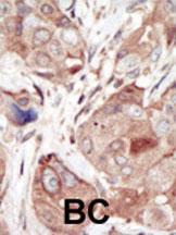 Anti-KDR Rabbit Polyclonal Antibody (HRP (Horseradish Peroxidase))