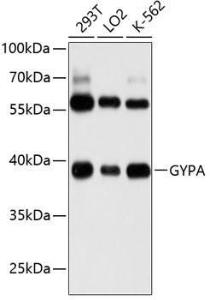 Anti-Glycophorin A Rabbit Polyclonal Antibody