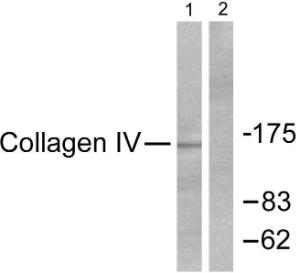 Antibody anti-collagen IV 100 µg