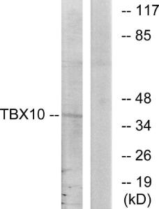 Western blot analysis of lysates from HT-29 cells using Anti-TBX10 Antibody. The right hand lane represents a negative control, where the antibody is blocked by the immunising peptide