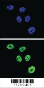 Anti-FEN1 Rabbit Polyclonal Antibody