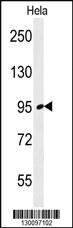 Anti-FNIP2 Rabbit Polyclonal Antibody