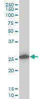 Anti-CAPNS1 Mouse Monoclonal Antibody [clone: 3C4]