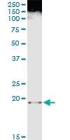 Anti-FTL Mouse Monoclonal Antibody [clone: 1C14]