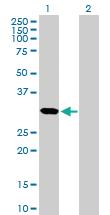 Anti-CDCA5 Mouse Polyclonal Antibody