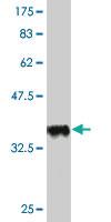 Anti-AMPD2 Mouse Monoclonal Antibody [clone: 3C5]