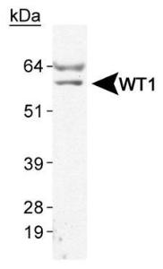 Anti-WT1 Mouse Monoclonal Antibody [clone: 6F-H2]