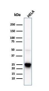 Anti-HSP27 antibody