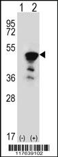 Anti-FEN1 Rabbit Polyclonal Antibody