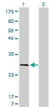 Anti-CAPNS1 Mouse Monoclonal Antibody [clone: 3C4]