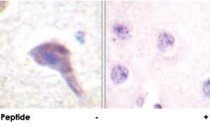 Anti-PRKD1 Rabbit Polyclonal Antibody