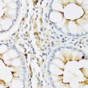 Immunohistochemistry analysis of paraffin-embedded human colon tissue using Anti-Ribonuclease 3/ECP Antibody (A8972) at a dilution of 1:100 (40X lens). Perform microwave antigen retrieval with 10 mM PBS buffer pH 7.2 before commencing with IHC staining protocol