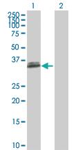 Anti-CDCA3 Mouse Polyclonal Antibody