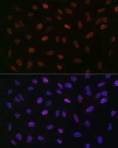 Immunofluorescence analysis of U-2 OS cells using Anti-ASH2L Antibody [ARC0326] (A305306) at a dilution of 1:100 (40x lens). DAPI was used to stain the cell nuclei (blue).