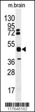 Anti-HNRNPK Rabbit Polyclonal Antibody