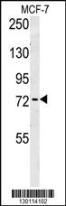 Anti-ARHGAP44 Rabbit Polyclonal Antibody