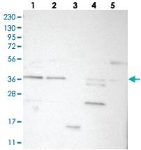 Anti-ELP5 Rabbit Polyclonal Antibody