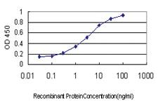 Anti-EVL Mouse Monoclonal Antibody [clone: 5G1]