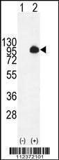 Anti-MUC20 Rabbit Polyclonal Antibody (Biotin)