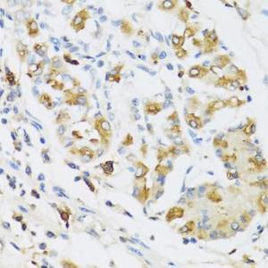 Immunohistochemistry analysis of paraffin-embedded human stomach using Anti-Ribonuclease 3/ECP Antibody (A8972) at a dilution of 1:100 (40X lens). Perform microwave antigen retrieval with 10 mM PBS buffer pH 7.2 before commencing with IHC staining protocol