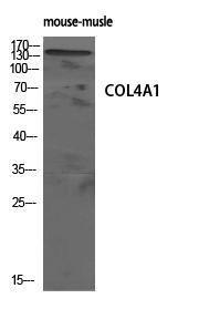 Antibody anti-collagen IV 100 µg