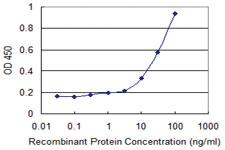 Anti-VDAC3 Mouse Monoclonal Antibody [clone: 1C6]