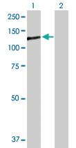 Anti-PTPRN Rabbit Polyclonal Antibody