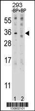 Anti-EBI3 Rabbit Polyclonal Antibody (FITC (Fluorescein Isothiocyanate))