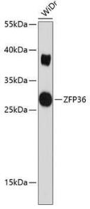 Anti-Tristetraprolin/TTP Antibody (A8974)