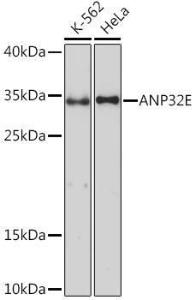 Anti-ANP32E antibody