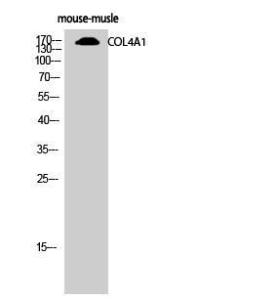 Antibody anti-collagen IV 100 µg