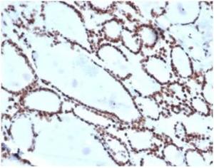 Immunohistochemical analysis of formalin-fixed, paraffin-embedded human thyroid using Anti-HOXB2 Antibody [PCRP-HOXB2-1F2] at 2 µg/ml in PBS for 30  minutes at room temperature