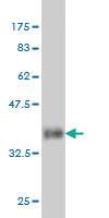 Anti-PIN1 Mouse Monoclonal Antibody [clone: 2F2]