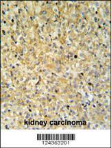 Anti-MAPK1IP1L Rabbit Polyclonal Antibody (HRP (Horseradish Peroxidase))