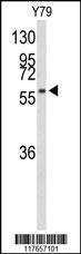 Anti-HSPD1 Rabbit Polyclonal Antibody