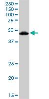 Anti-VDR Mouse Polyclonal Antibody