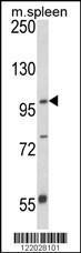 Anti-ANO5 Rabbit Polyclonal Antibody (FITC (Fluorescein))