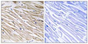 Immunohistochemical analysis of paraffin-embedded human heart tissue using Anti-PEA-15 Antibody. The right hand panel represents a negative control, where the antibody was pre-incubated with the immunising peptide