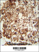 Anti-ITGAM Rabbit Polyclonal Antibody