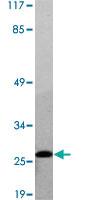 Anti-BCL2 Rabbit Polyclonal Antibody