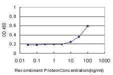 Anti-CDCA3 Mouse Monoclonal Antibody [clone: 3B9]