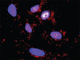 Anti-STK11 + RPS6KB1 Antibody Pair